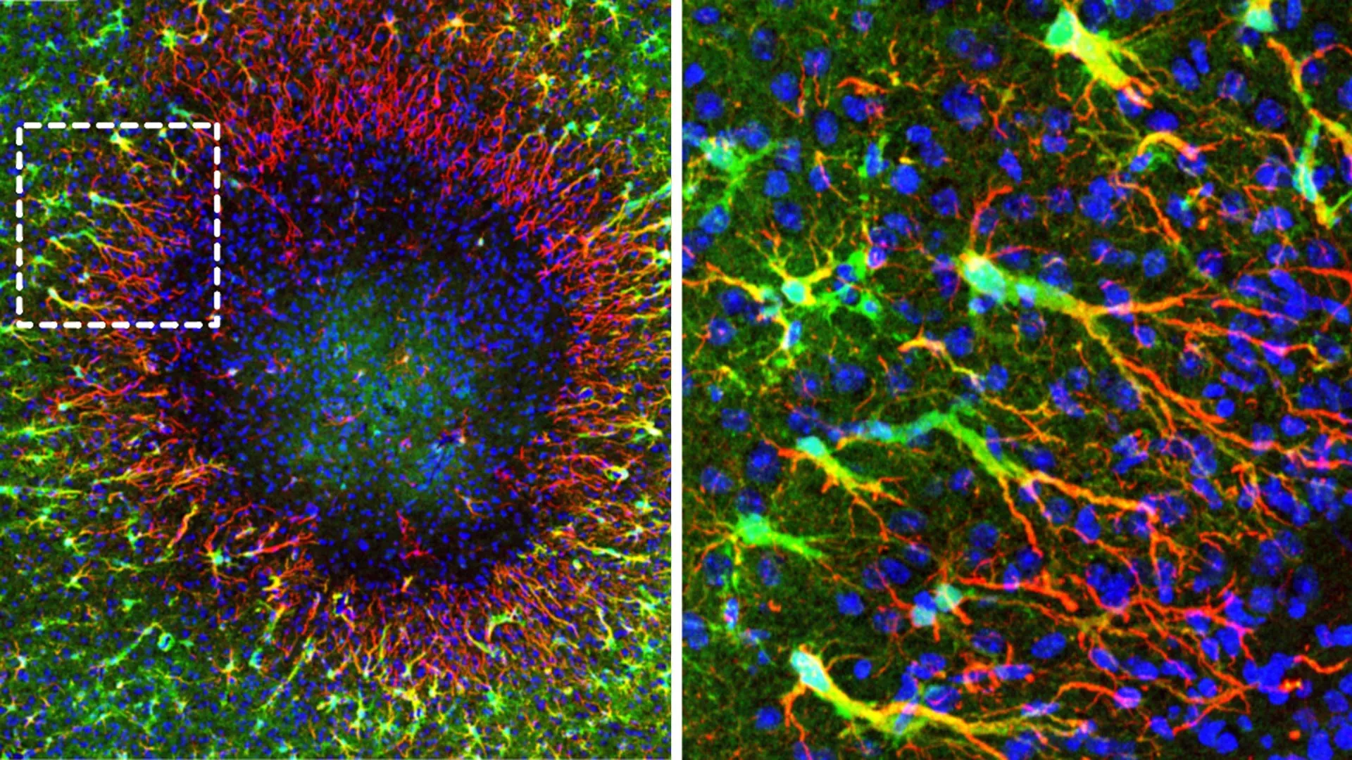 brain repair mechanisms